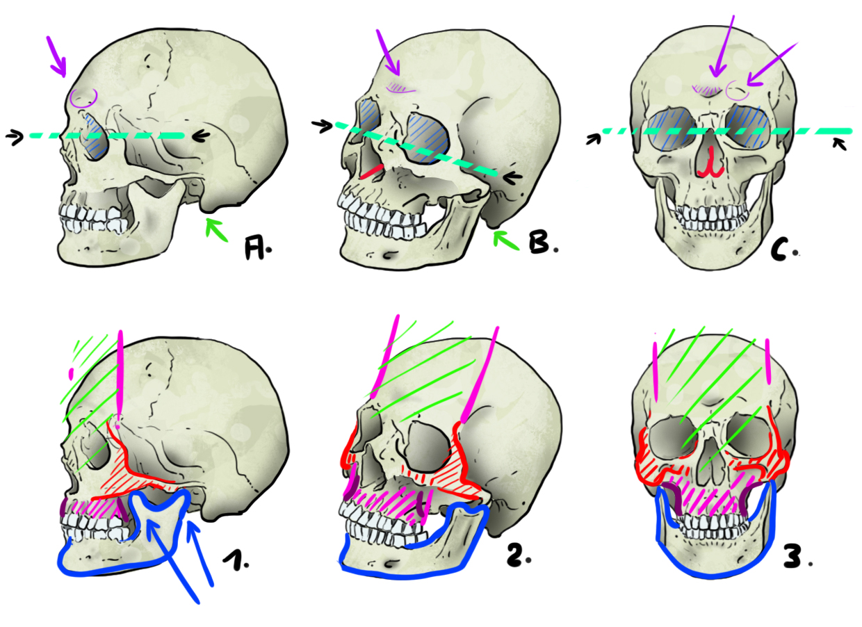dessins de crâne en vue de face, de profil et de trois-quart