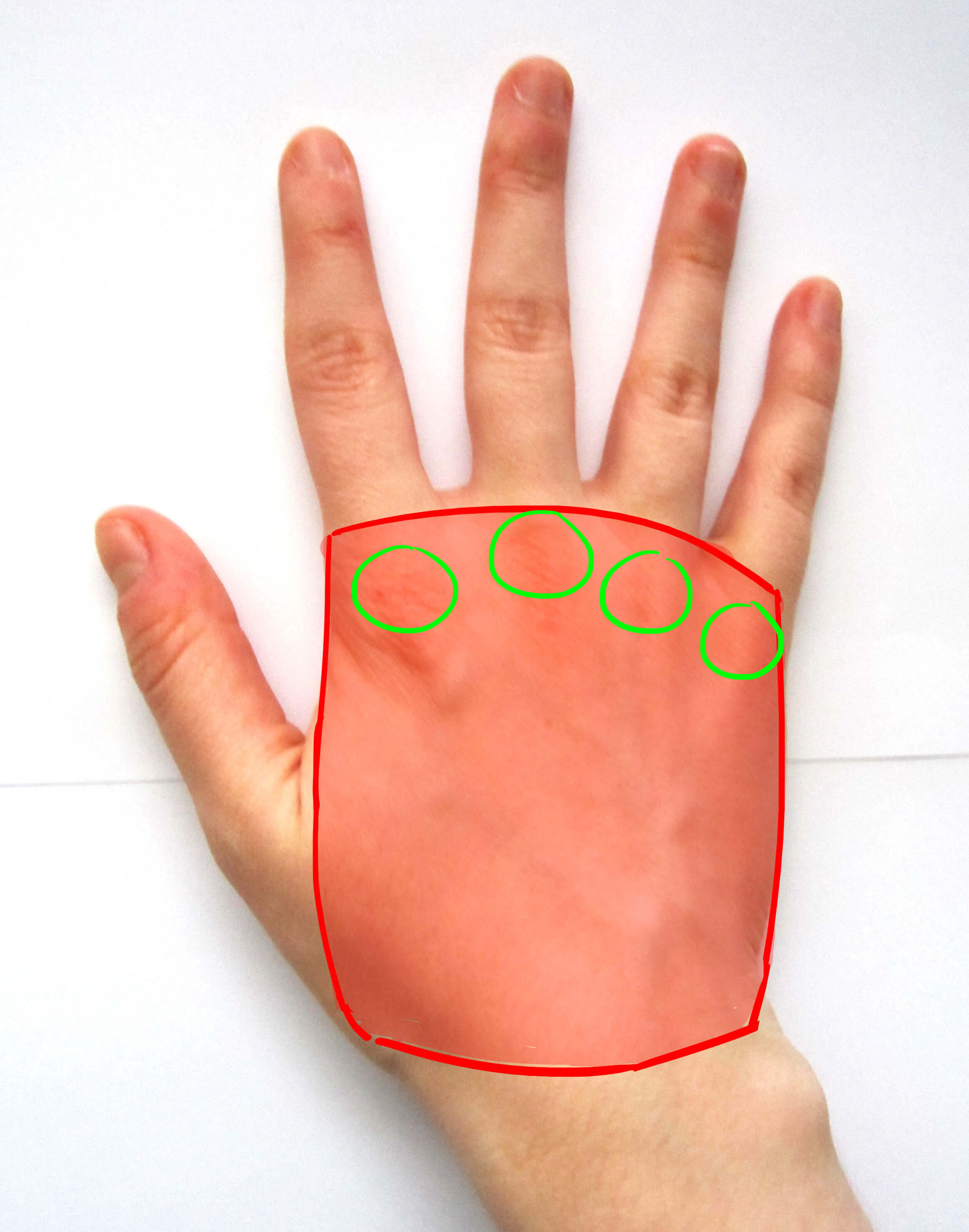 Articulations de la paume de la main de dos