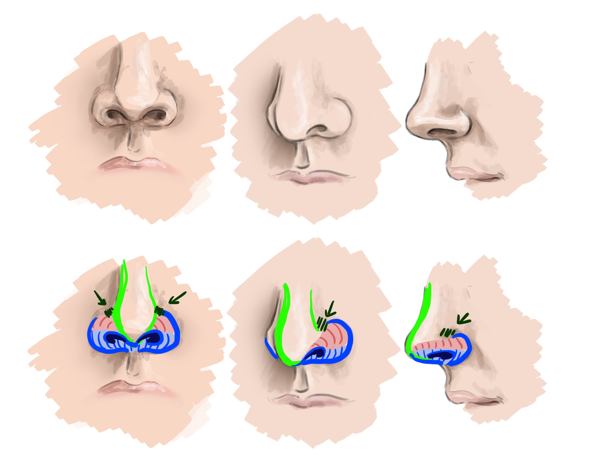 dessins des narines du nez de face, de 3/4 et de profil